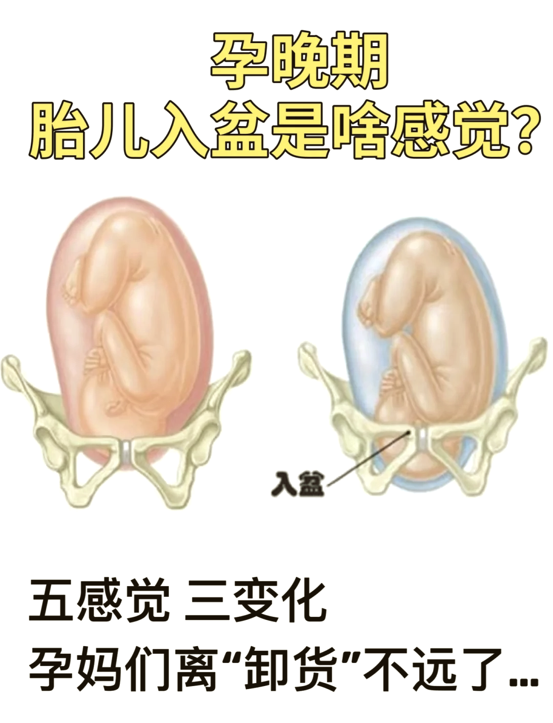 怀孕8个月胎儿入盆图图片