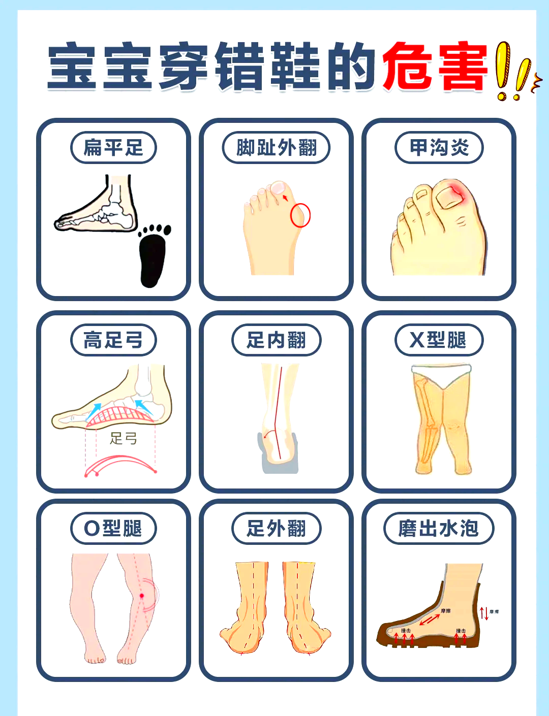 儿童足部发育过程图图片